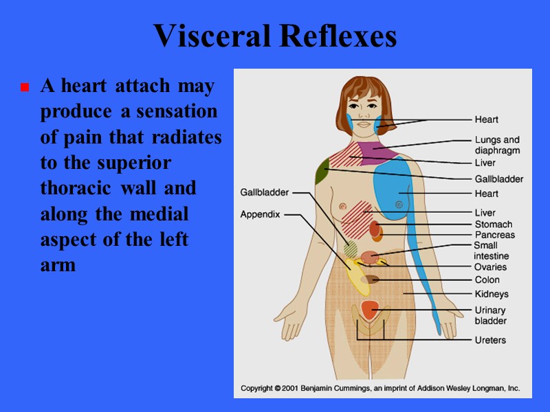 Visceral Reflexes A heart attach may produce a sensation of pain that radiates to